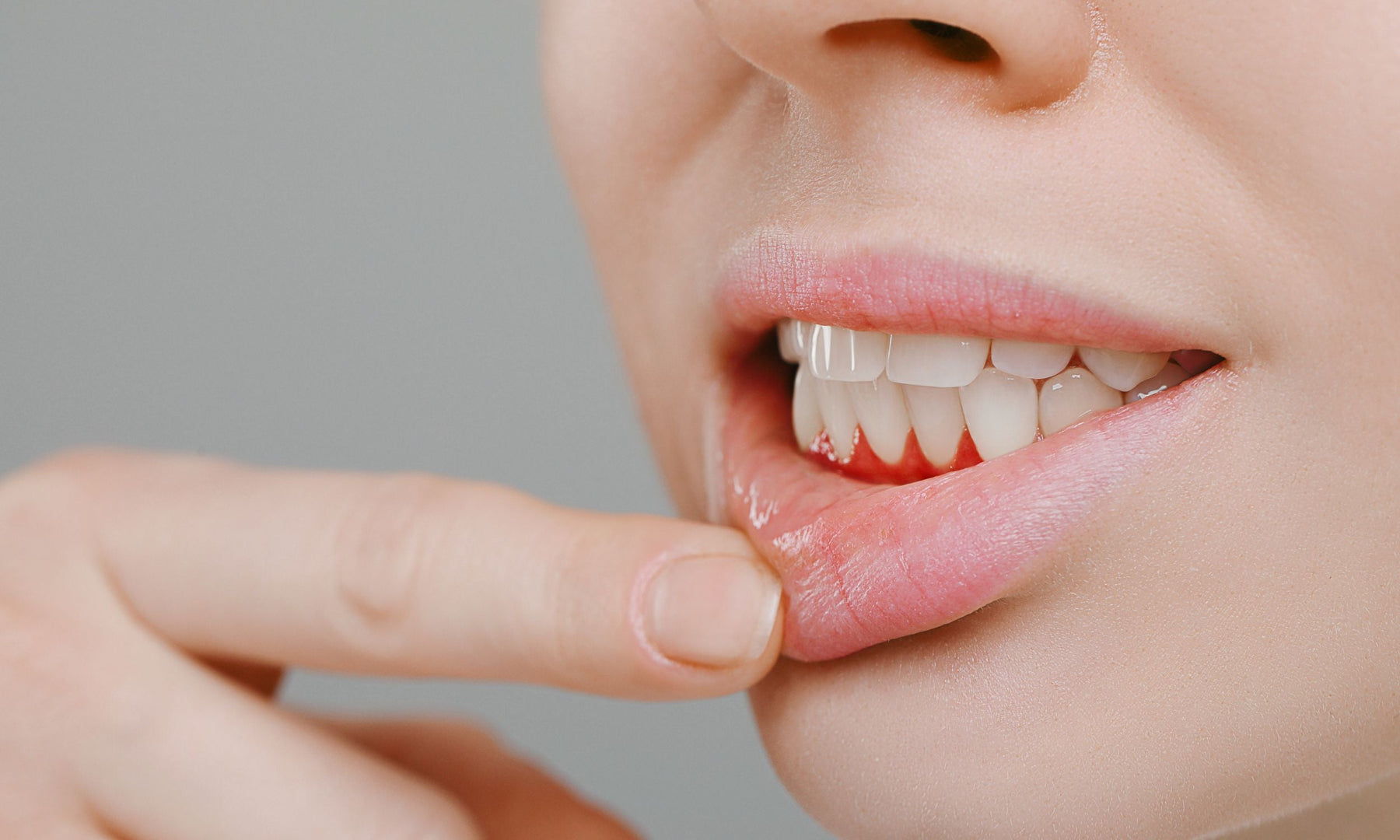 Bleeding and Inflamed Gums – What to Do Next