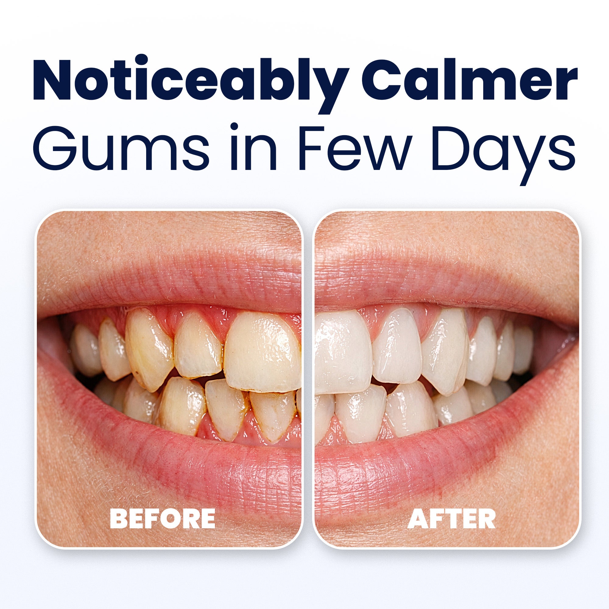 Close-up of teeth and gums showing a calm and healthy smile.