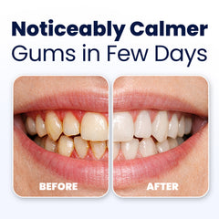 Close-up of teeth and gums showing a calm and healthy smile.