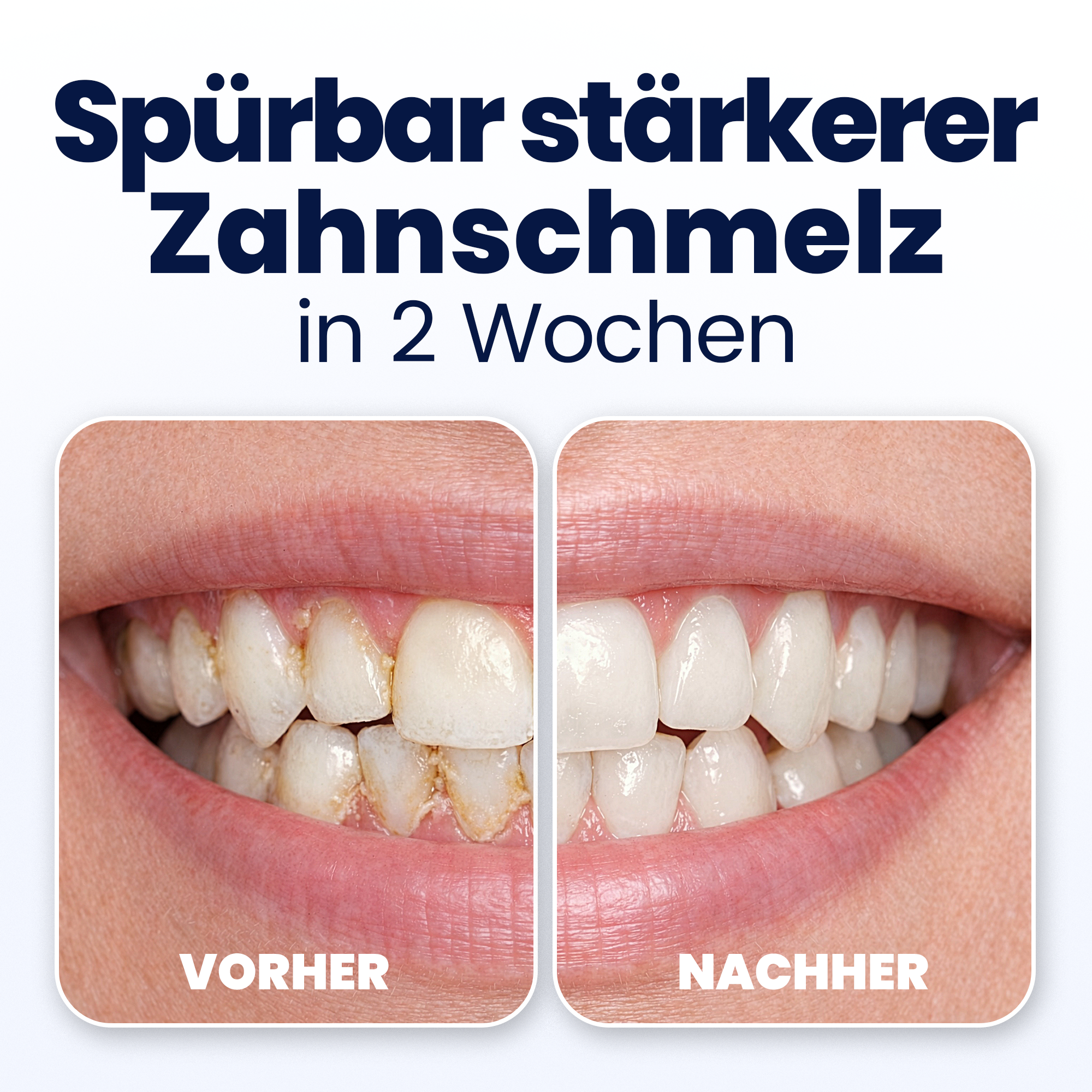 Before and after comparison of teeth with German text indicating two-week results.