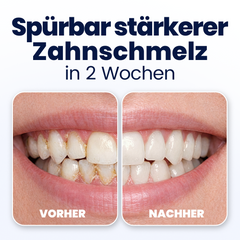 Before and after comparison of teeth with German text indicating two-week results.