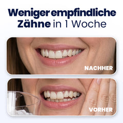 Before and after comparison of teeth whitening with German text indicating results in one week.