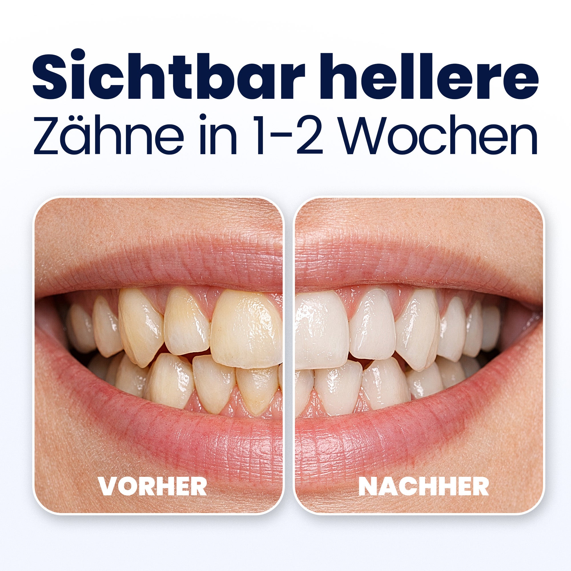 Before and after comparison of teeth with visible text indicating improved tooth appearance.