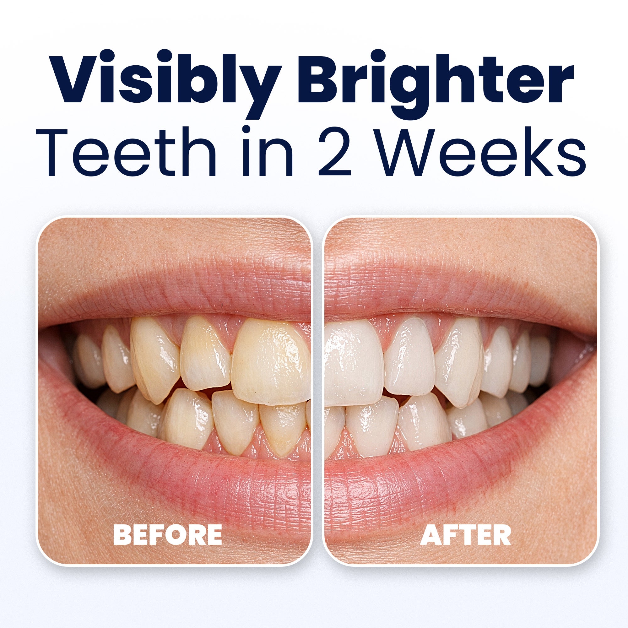 Before and after showing visibly brighter teeth in 2 weeks with a mouth close-up.